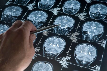 Your Brain On Risk: It’s Not Good