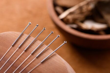 Why Acupuncture Is Becoming A Must-Have In Executive Wellness Programs